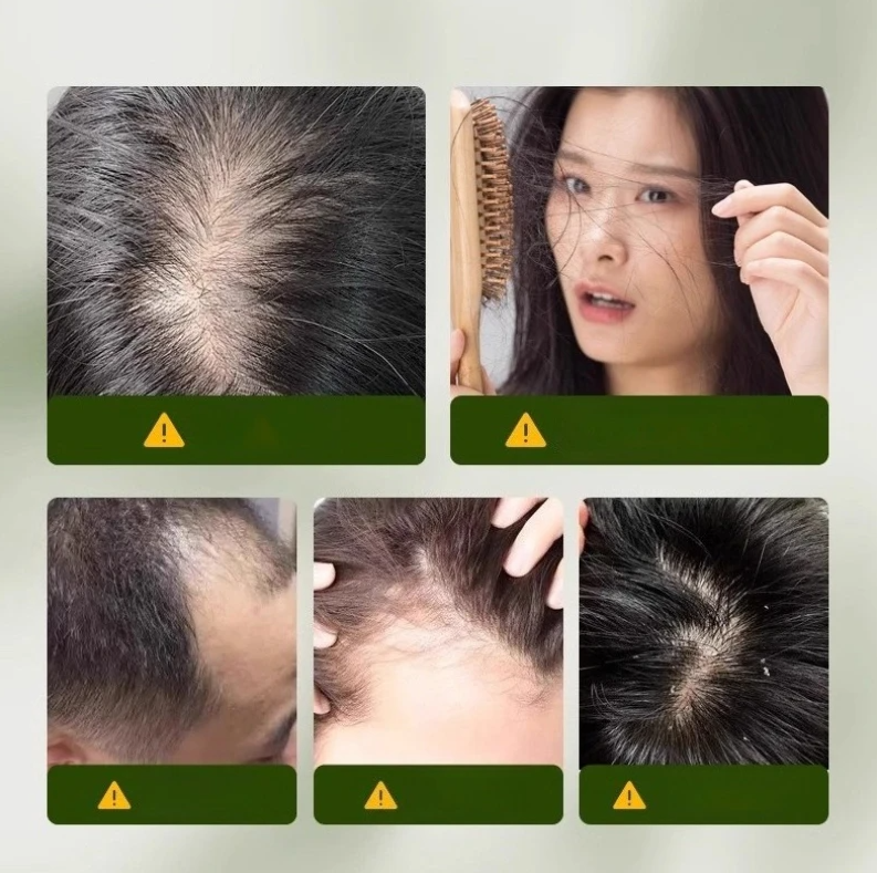 Root Activator Soap Bar for Hair Loss