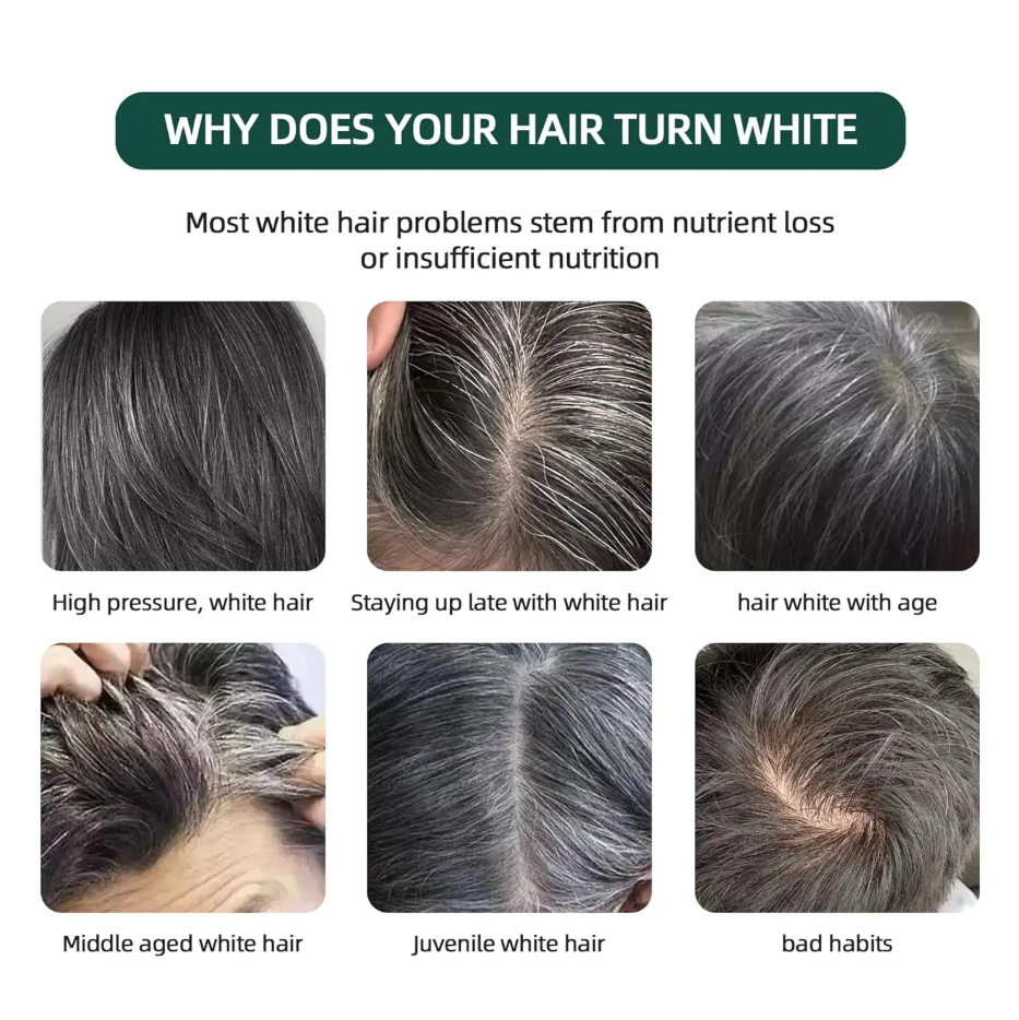 Root Activator Soap Bar for Hair Loss